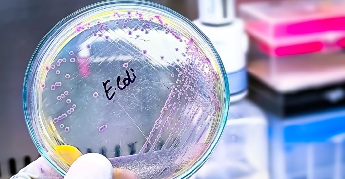 Petrischale mit E-Coli-Bakterien