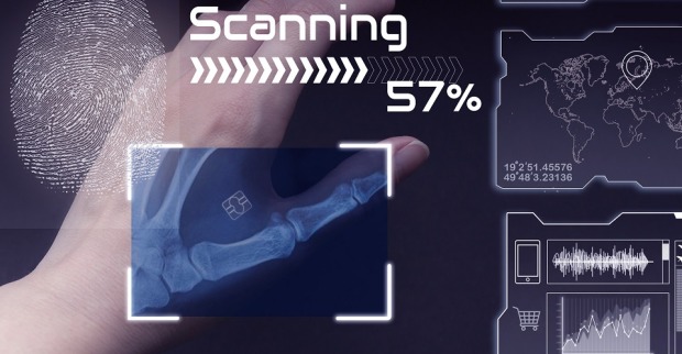 Röntgenaufnahme von einer Hand mit einem Chip, der unter die Haut implantiert ist.