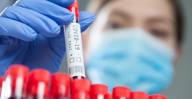 PCR-Gurgeltest