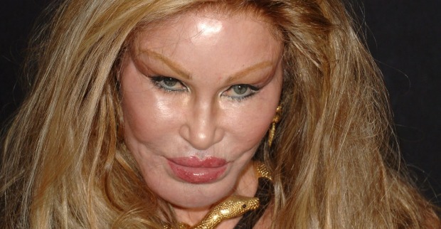 Ihr durch Schönheitsoperationen entstandenes Aussehen hat Jocelyn Wildenstein den Spitznamen "Catwoman" eingebracht.