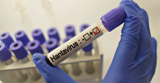 Blutprobe für Hantavirus-Test im medizinischen Labor.